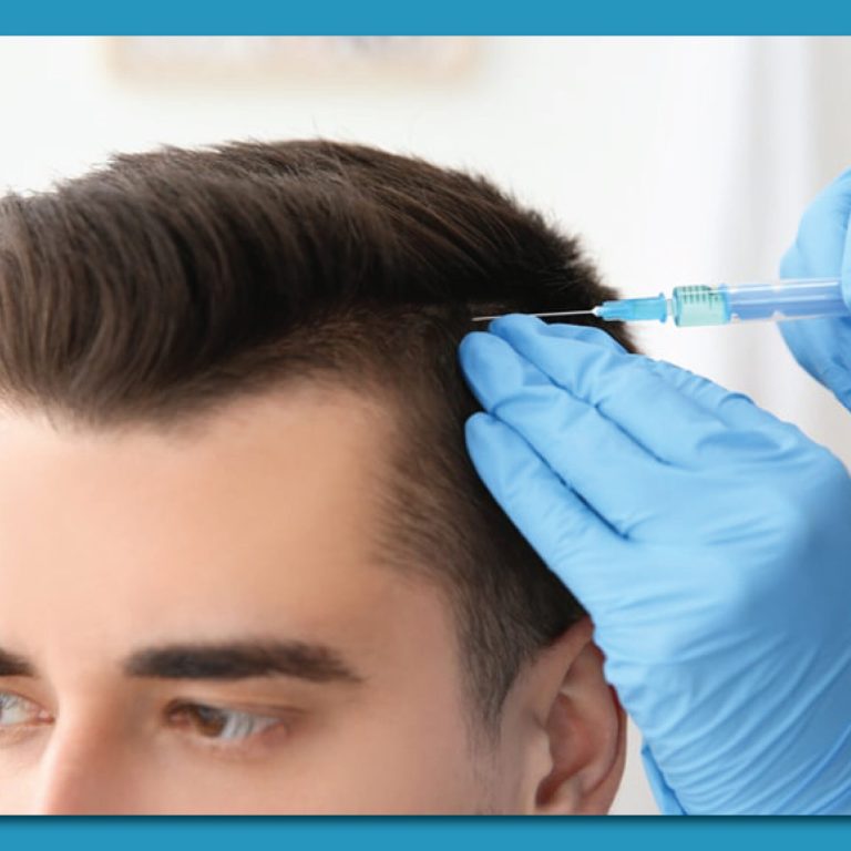PRP Hair Restoration The Natural Solution for Thinning Hair