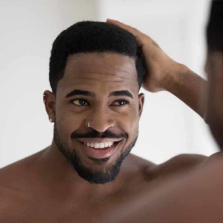 afro hair transplants (1)