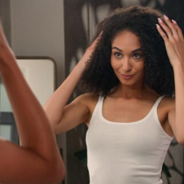 afro hair transplants female