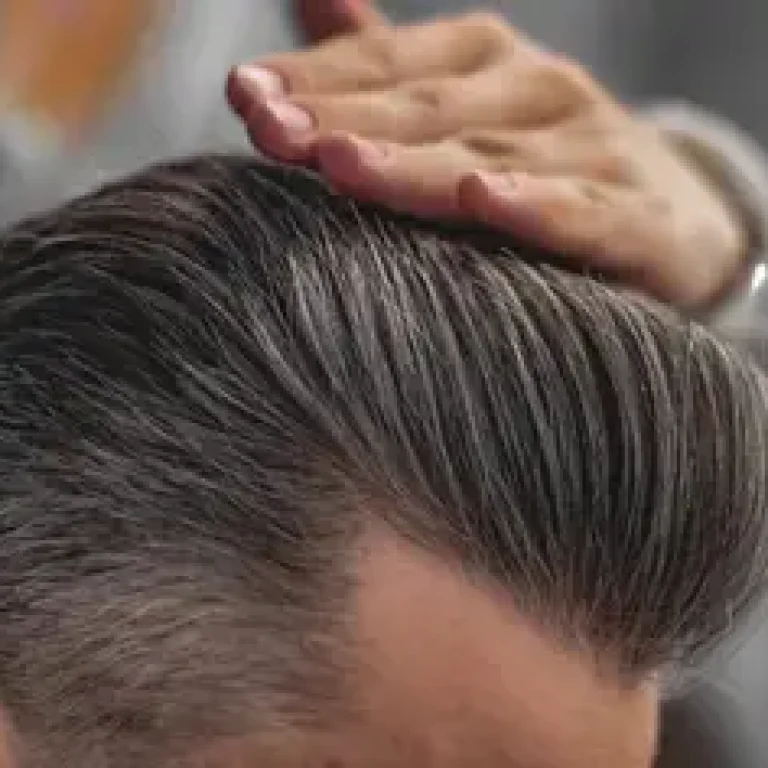 hair-system-gallery